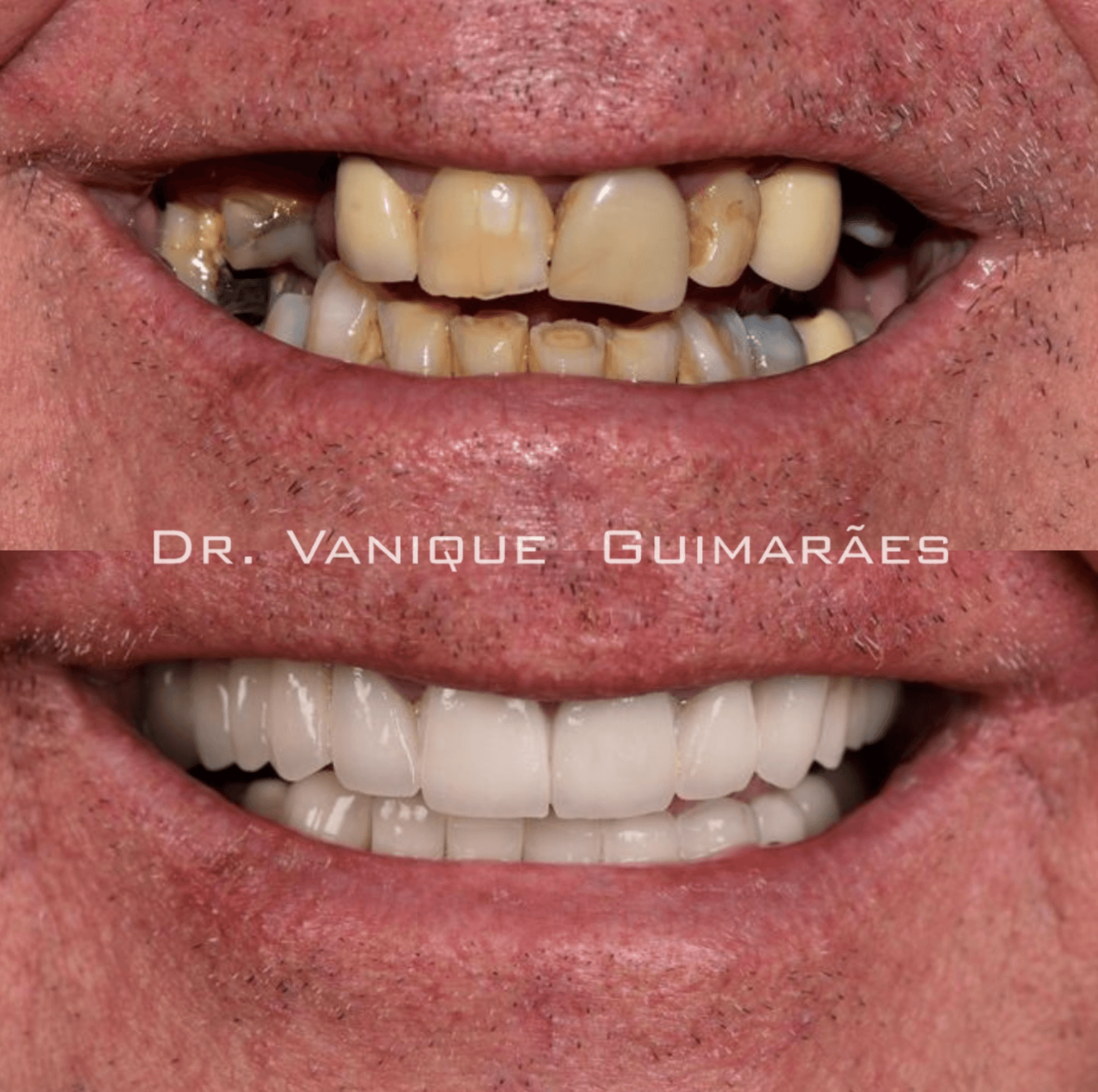 Antes e depois 2