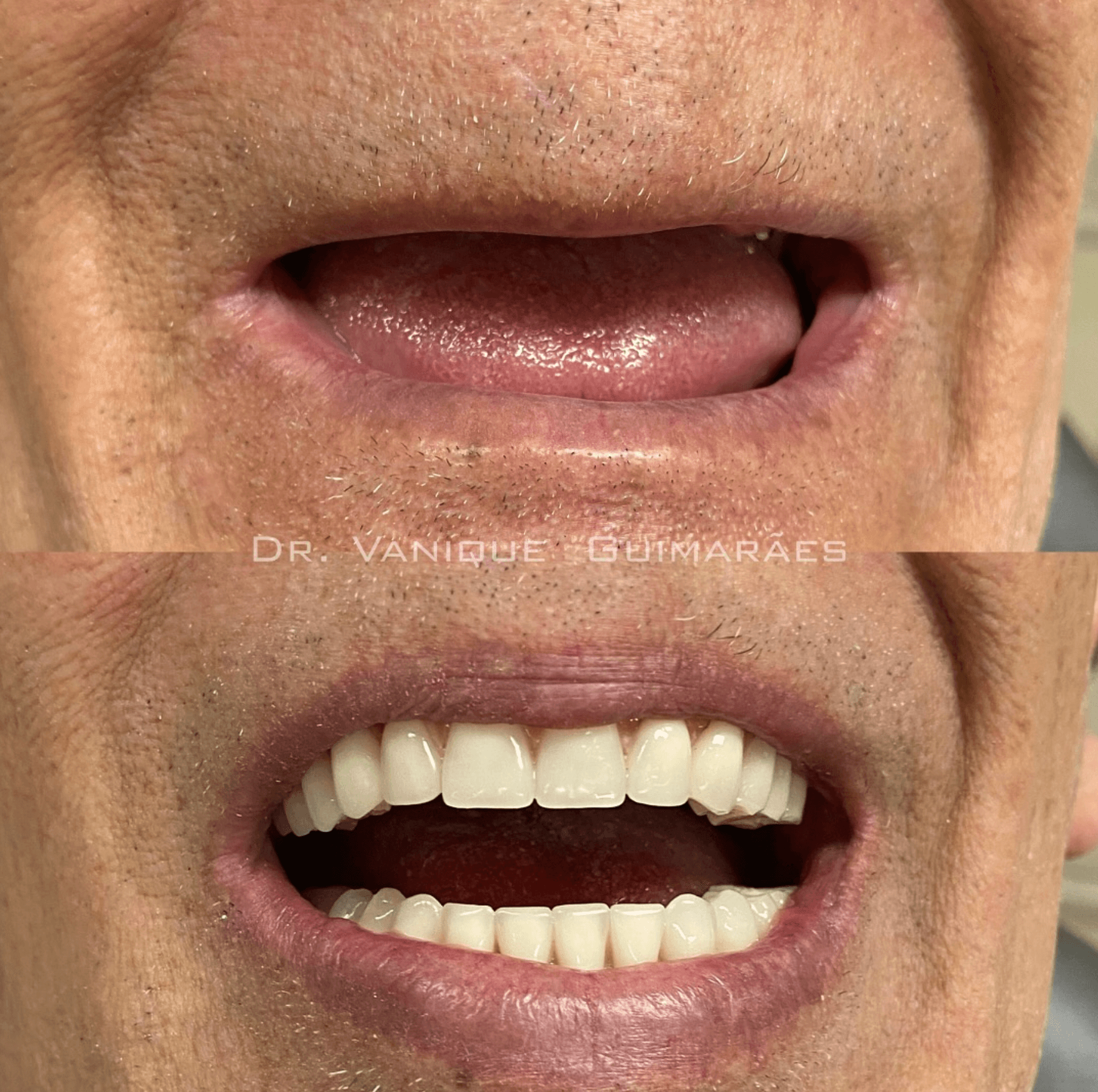 Antes e depois 5