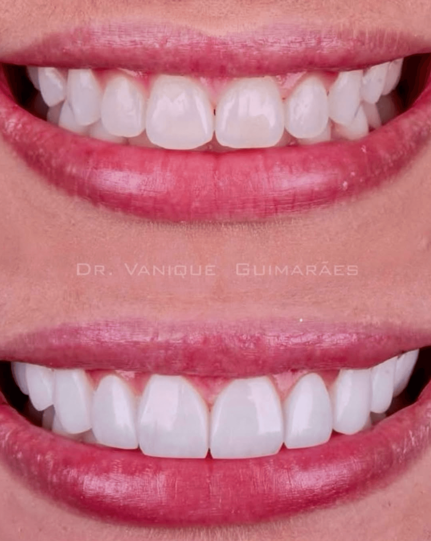 Antes e depois 6