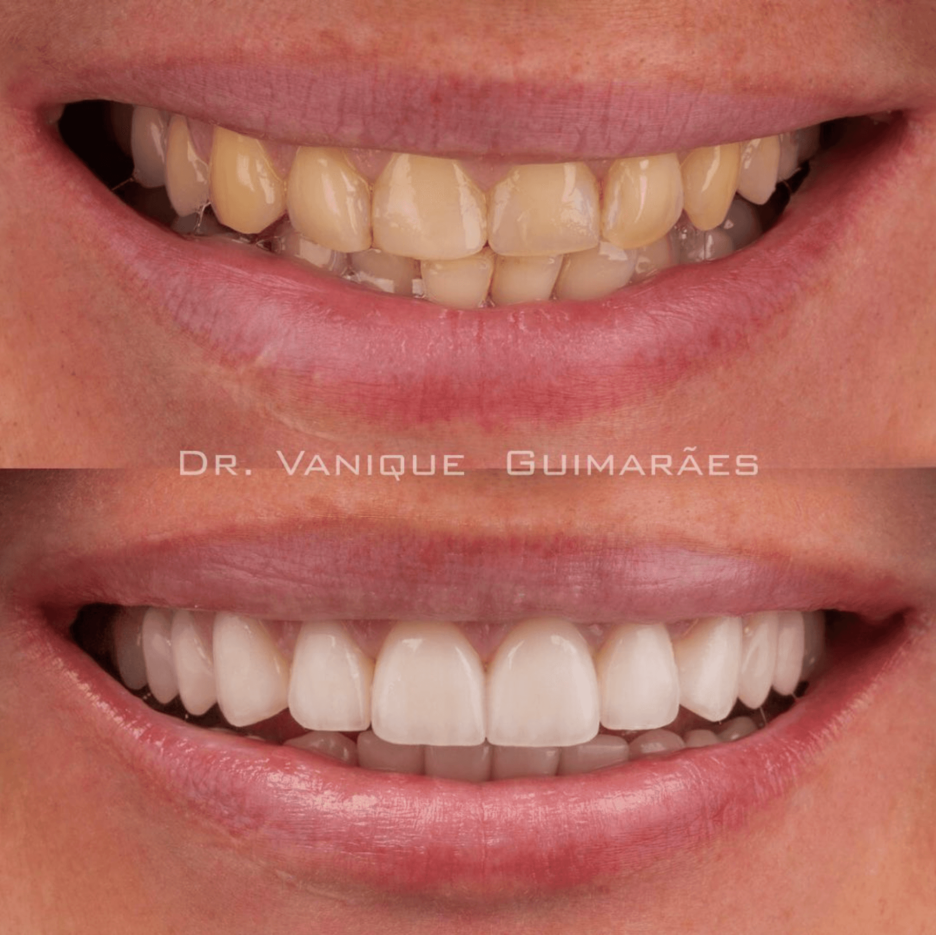 Antes e depois 8